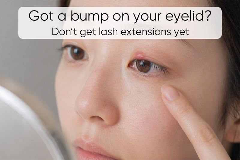 Got a bump on your eyelid? Don’t get lash extensions yet